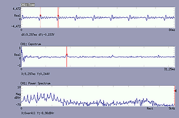 Display data (Cepstrum)