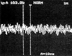 データ（加速度検出器からの時間軸信号）